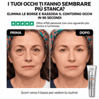 Tensore Occhi Anti-Età – Effetto Giovane in 90 Secondi