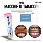 Dentifricio sbiancante alla niacinamide - TriBright
