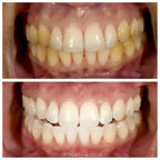 Dentifricio sbiancante alla niacinamide - TriBright
